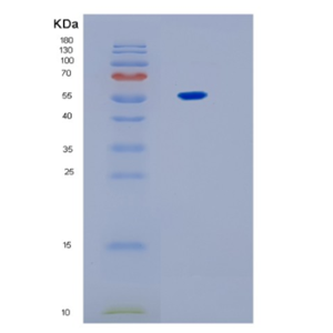 Recombinant Human IL17RB Protein