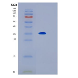Recombinant Human IL1RL1 Protein