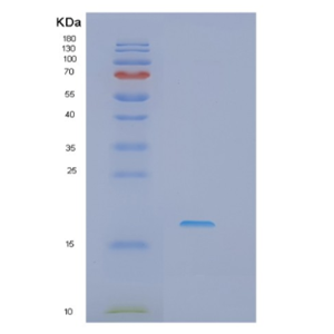 Recombinant Human IFT20 Protein,Recombinant Human IFT20 Protein