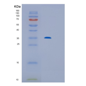 Recombinant Human IL12P40 Protein,Recombinant Human IL12P40 Protein