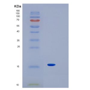 Recombinant Human IL1F10 Protein,Recombinant Human IL1F10 Protein