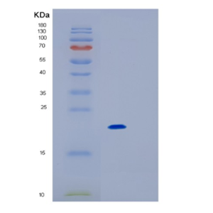 Recombinant Human IL18BP Protein