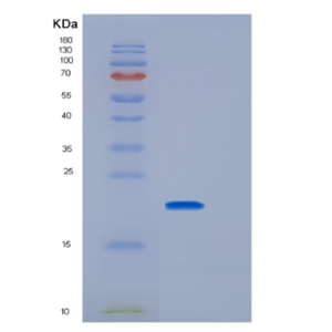 Recombinant Rat Il33 Protein,Recombinant Rat Il33 Protein