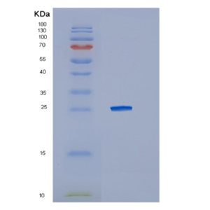 Recombinant Human IL10RA Protein,Recombinant Human IL10RA Protein