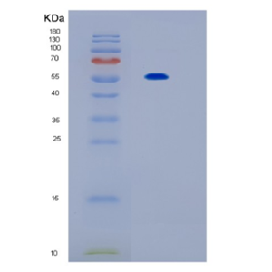 Recombinant Mouse Il17rb Protein