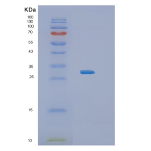 Recombinant Human IL34 Protein,Recombinant Human IL34 Protein