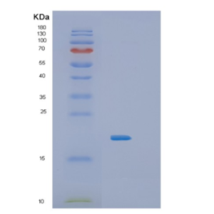 Recombinant Human IL36RN Protein