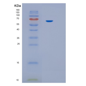 Recombinant Human IL12RB1 Protein