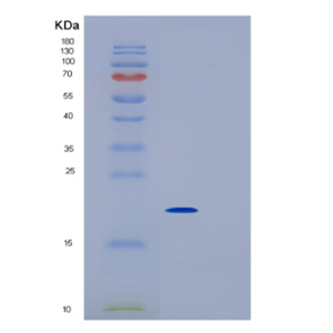 Recombinant Mouse IL1RN Protein,Recombinant Mouse IL1RN Protein