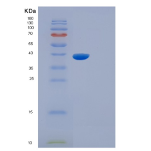 Recombinant Mouse Il5ra Protein,Recombinant Mouse Il5ra Protein