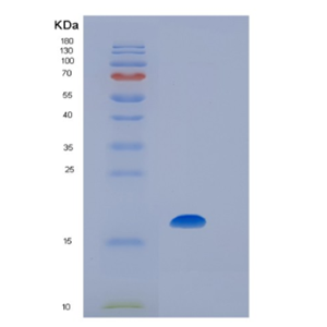 Recombinant Human IL7 Protein,Recombinant Human IL7 Protein