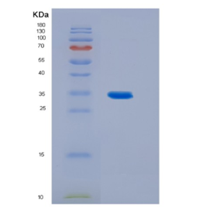 Recombinant Human IL23 Protein,Recombinant Human IL23 Protein