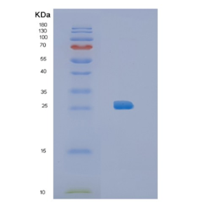 Recombinant Mouse IL34 Protein,Recombinant Mouse IL34 Protein