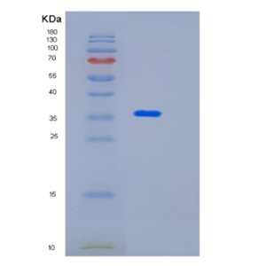 Recombinant Mouse Impad1 Protein