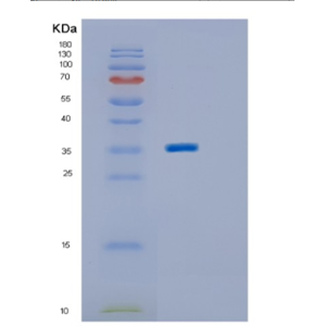 Recombinant Human ING2 Protein,Recombinant Human ING2 Protein