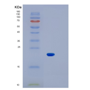 Recombinant Mouse IL1b Protein