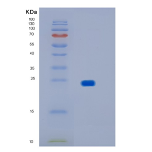 Recombinant Human IMP3 Protein,Recombinant Human IMP3 Protein