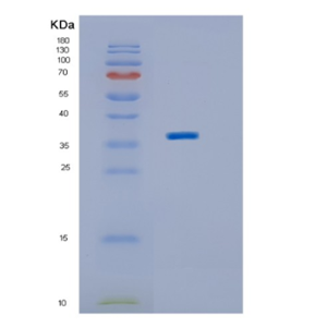 Recombinant Human IMPAD1 Protein