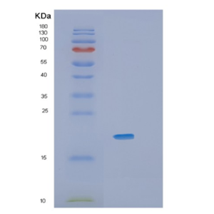 Recombinant Mouse Il36a Protein,Recombinant Mouse Il36a Protein