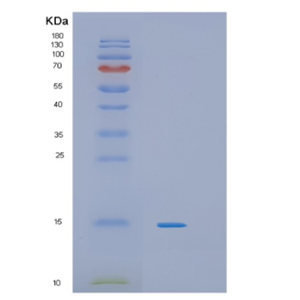 Recombinant Mouse IL4 Protein,Recombinant Mouse IL4 Protein