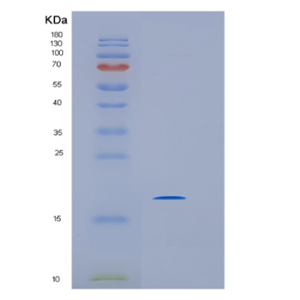 Recombinant Human IMMP2L Protein,Recombinant Human IMMP2L Protein