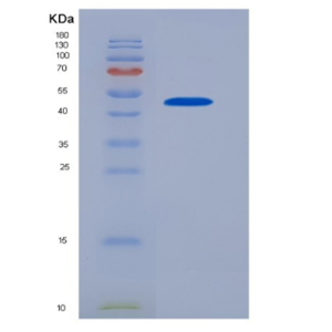 Recombinant Mouse Interferon-β 1 Protein,Recombinant Mouse Interferon-β 1 Protein