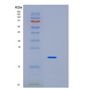 Recombinant Human Interleukin-10 Protein,Recombinant Human Interleukin-10 Protein