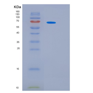 Recombinant Mouse Interleukin-6 receptor subunit beta Protein