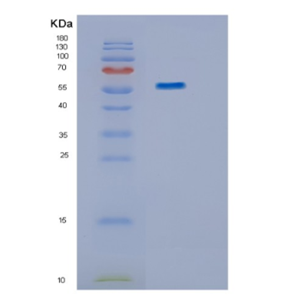 Recombinant Human IMPDH1 Protein,Recombinant Human IMPDH1 Protein