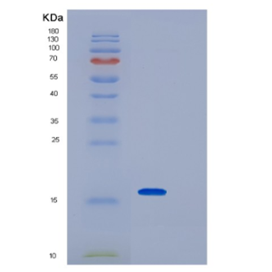 Recombinant E.coli IPP-POZ domain(1-157aa) Protein