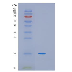 Recombinant Human IRF2 Protein,Recombinant Human IRF2 Protein