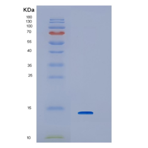 Recombinant Human Interferon regulatory factor-3 Protein,Recombinant Human Interferon regulatory factor-3 Protein