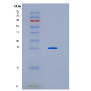 Recombinant Human Interleukin-21 receptor Protein