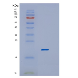 Recombinant Human Interleukin 6 Protein,Recombinant Human Interleukin 6 Protein