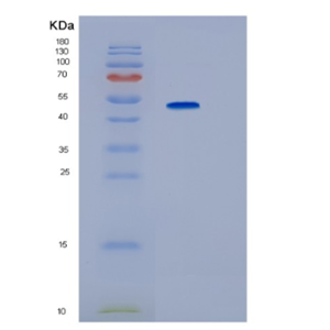 Recombinant Human IP6K2 Protein,Recombinant Human IP6K2 Protein