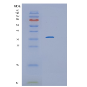 Recombinant Human Interleukin-1 receptor type 1 Protein