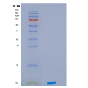 Recombinant Human IRF5 Protein,Recombinant Human IRF5 Protein