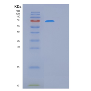 Recombinant Human ITGB1 Protein