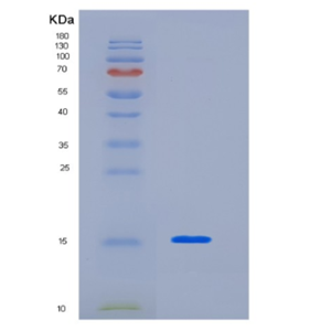 Recombinant Human KHDC1L Protein,Recombinant Human KHDC1L Protein