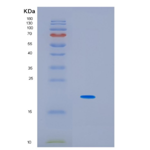 Recombinant Human Interleukin-6 Protein,Recombinant Human Interleukin-6 Protein