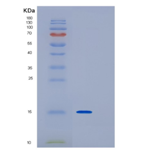 Recombinant Human IRF1 Protein,Recombinant Human IRF1 Protein