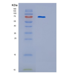 Recombinant Human ITGB2 Protein,Recombinant Human ITGB2 Protein