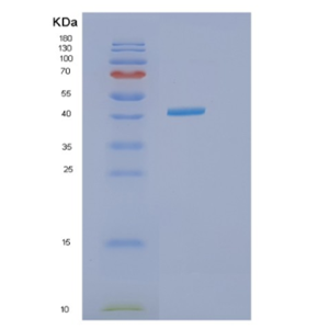 Recombinant Human IVD Protein,Recombinant Human IVD Protein