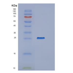 Recombinant Human IYD Protein,Recombinant Human IYD Protein