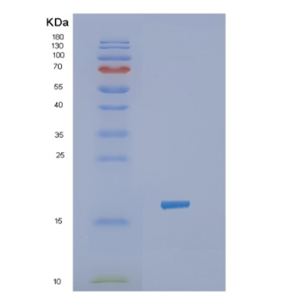 Recombinant Human JAK2 Protein,Recombinant Human JAK2 Protein