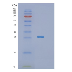 Recombinant Human JAM2 Protein,Recombinant Human JAM2 Protein