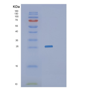 Recombinant Human JAM3 Protein,Recombinant Human JAM3 Protein