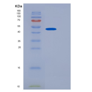 Recombinant Human JMJD6 Protein