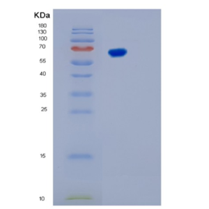 Recombinant Human KARS Protein,Recombinant Human KARS Protein