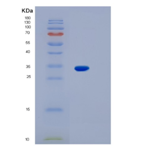 Recombinant Human KCNIP3 Protein